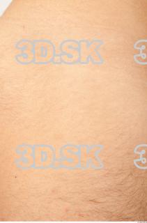 Skin texture of Franklin 0002